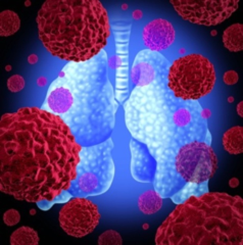 Is Vitamin D an anti-cancer agent?