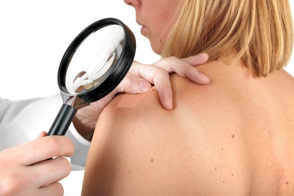 Omega-3s may help prevent skin cancer