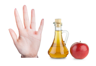 Apple Cider Vinegar wart remedy