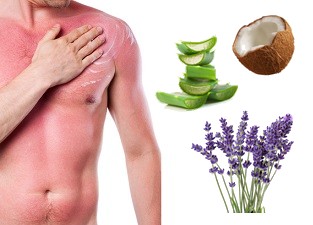 Natural homemade sunburn spray