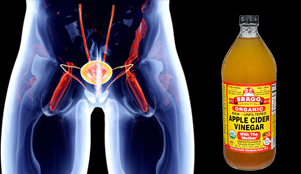 Apple cider vinegar Urinary Tract Infection treatment