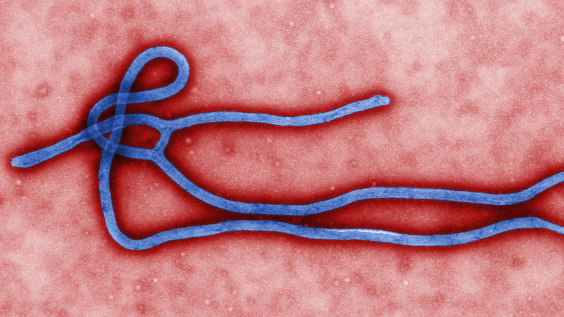 CDC director Dr. Tom Friedman states U.S. ‘surging’ efforts to stop Ebola
