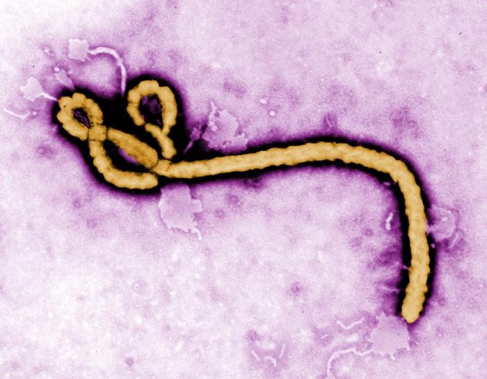 CDC confirms first Ebola case diagnosed in the U.S.