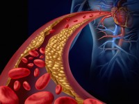 Elevated cholesterol may increase prostate cancer risk