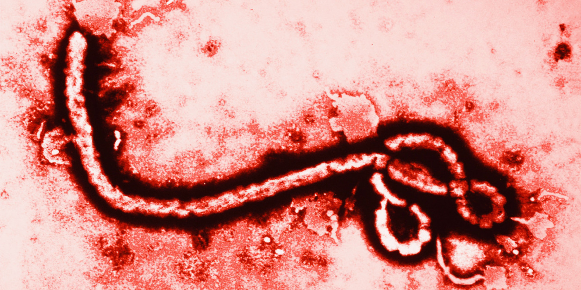 Patient being tested for Ebola at Howard University Hospital in D.C.