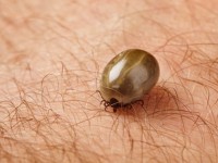 How to get rid of a tick