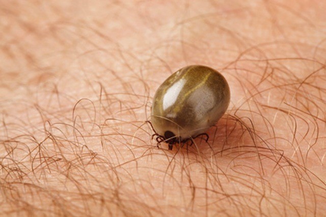 How to get rid of a tick