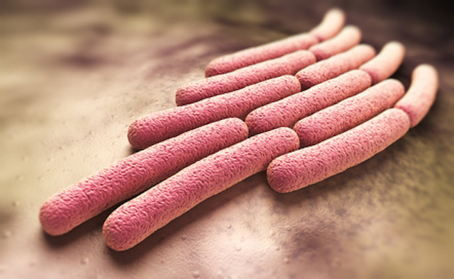 Drug resistant Shigellosis spreading in the United States