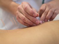 Acupuncture beats morphine for pain relief