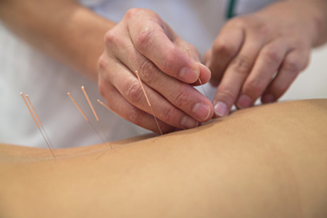 Acupuncture beats morphine for pain relief