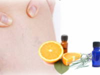 Lavender and orange oil spider vein remedy